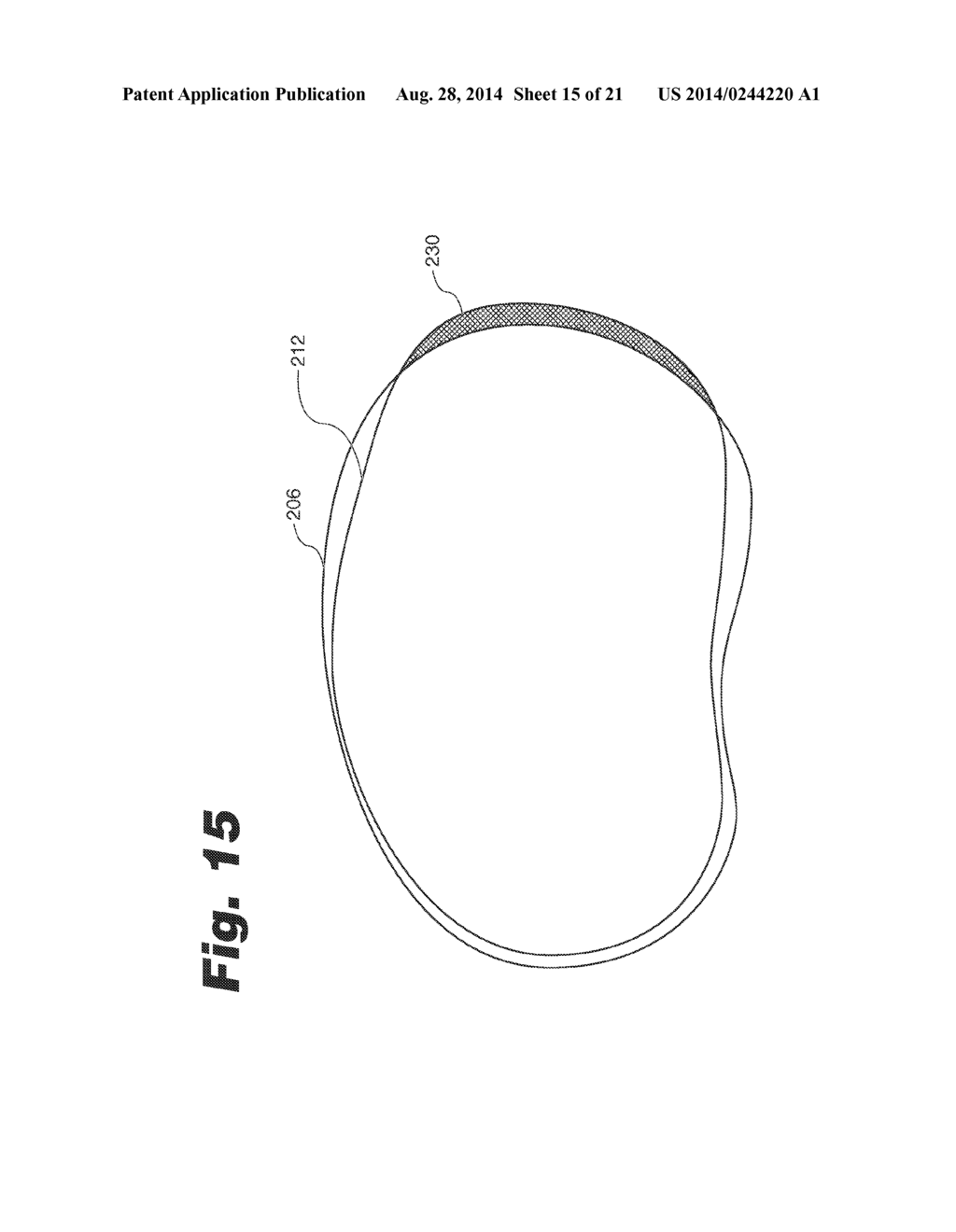 SYSTEMS AND METHODS FOR OPTIMIZING FIT OF AN IMPLANT TO ANATOMY - diagram, schematic, and image 16