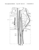 ZIPPER ASSEMBLY diagram and image