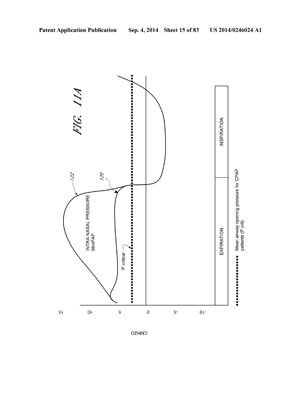 AUTO-FEEDBACK VALVE FOR A SLEEP APNEA DEVICE - diagram, schematic, and image 16