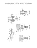 SUCTION PUMP AND APPARATUS FOR LOADING MATERIAL INTO A STENT STRUT diagram and image