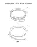 WEARABLE DEVICES WITH MAGNETS ENCASED BY A MATERIAL THAT REDISTRIBUTES     THEIR MAGNETIC FIELDS diagram and image