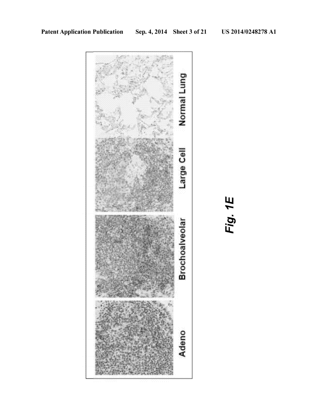 ANTI-CD22 ANTIGEN BINDING MOLECULES TO TREAT LUNG CANCER AND PROSTATE     CANCER - diagram, schematic, and image 04