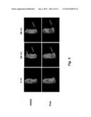 ANTI-CD22 ANTIGEN BINDING MOLECULES TO TREAT LUNG CANCER AND PROSTATE     CANCER diagram and image