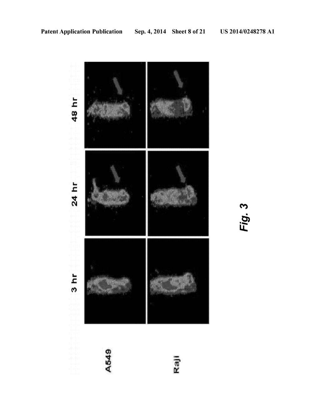 ANTI-CD22 ANTIGEN BINDING MOLECULES TO TREAT LUNG CANCER AND PROSTATE     CANCER - diagram, schematic, and image 09