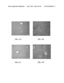 CONTROLLED RELEASE VACCINES AND METHODS FOR TREATING BRUCELLA DISEASES AND     DISORDERS diagram and image