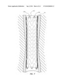 ELECTROSPUN PTFE COATED STENT AND METHOD OF USE diagram and image