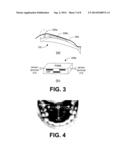 MULTIFUNCTIONAL ORAL PROSTHETIC SYSTEM diagram and image