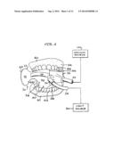 INTRAORAL DEVICE ADAPTER diagram and image