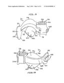 INTRAORAL DEVICE ADAPTER diagram and image