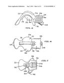 INTRAORAL DEVICE ADAPTER diagram and image