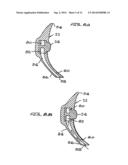 INTRAORAL DEVICE ADAPTER diagram and image