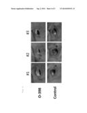 Compositions for Controlling Vascularization in Ophthalmological and     Dermatological Diseases diagram and image