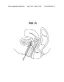 SYSTEM AND METHOD FOR NERVE STIMULATION diagram and image