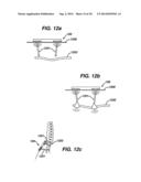 SYSTEM AND METHOD FOR NERVE STIMULATION diagram and image