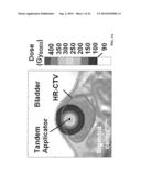 COMPENSATOR-BASED BRACHYTHERAPY diagram and image