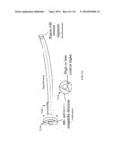 COMPENSATOR-BASED BRACHYTHERAPY diagram and image