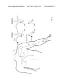 BODY-WORN SYSTEM FOR CONTINUOUS, NONINVASIVE MEASUREMENT OF CARDIAC     OUTPUT, STROKE VOLUME, CARDIAC POWER, AND BLOOD PRESSURE diagram and image