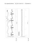 BODY-WORN SYSTEM FOR CONTINUOUS, NONINVASIVE MEASUREMENT OF CARDIAC     OUTPUT, STROKE VOLUME, CARDIAC POWER, AND BLOOD PRESSURE diagram and image