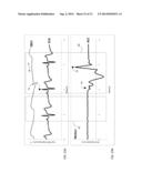 BODY-WORN SYSTEM FOR CONTINUOUS, NONINVASIVE MEASUREMENT OF CARDIAC     OUTPUT, STROKE VOLUME, CARDIAC POWER, AND BLOOD PRESSURE diagram and image