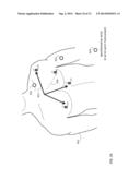 BODY-WORN SYSTEM FOR CONTINUOUS, NONINVASIVE MEASUREMENT OF CARDIAC     OUTPUT, STROKE VOLUME, CARDIAC POWER, AND BLOOD PRESSURE diagram and image