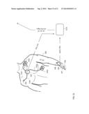 BODY-WORN SYSTEM FOR CONTINUOUS, NONINVASIVE MEASUREMENT OF CARDIAC     OUTPUT, STROKE VOLUME, CARDIAC POWER, AND BLOOD PRESSURE diagram and image