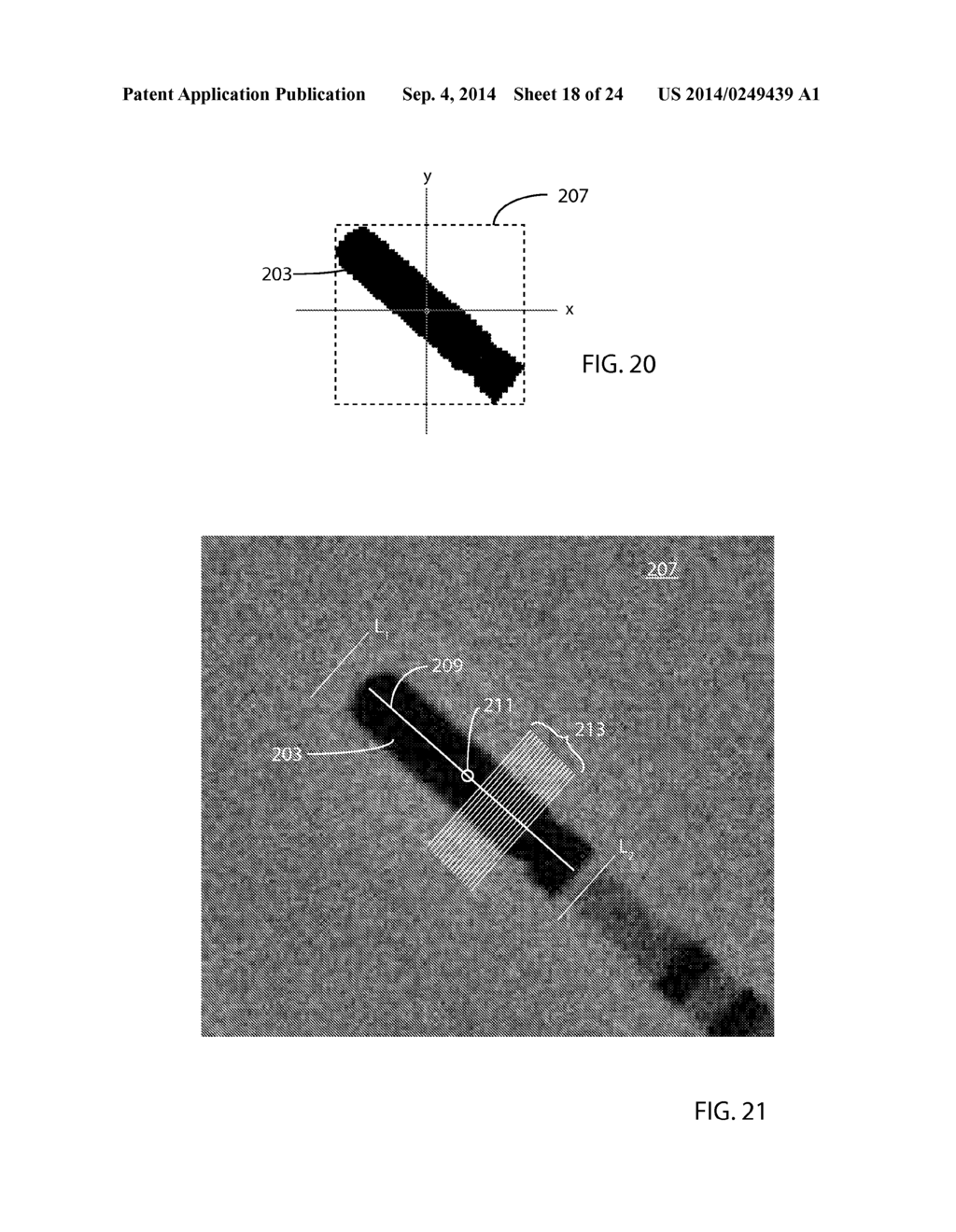 R-Wave Detection Method - diagram, schematic, and image 19