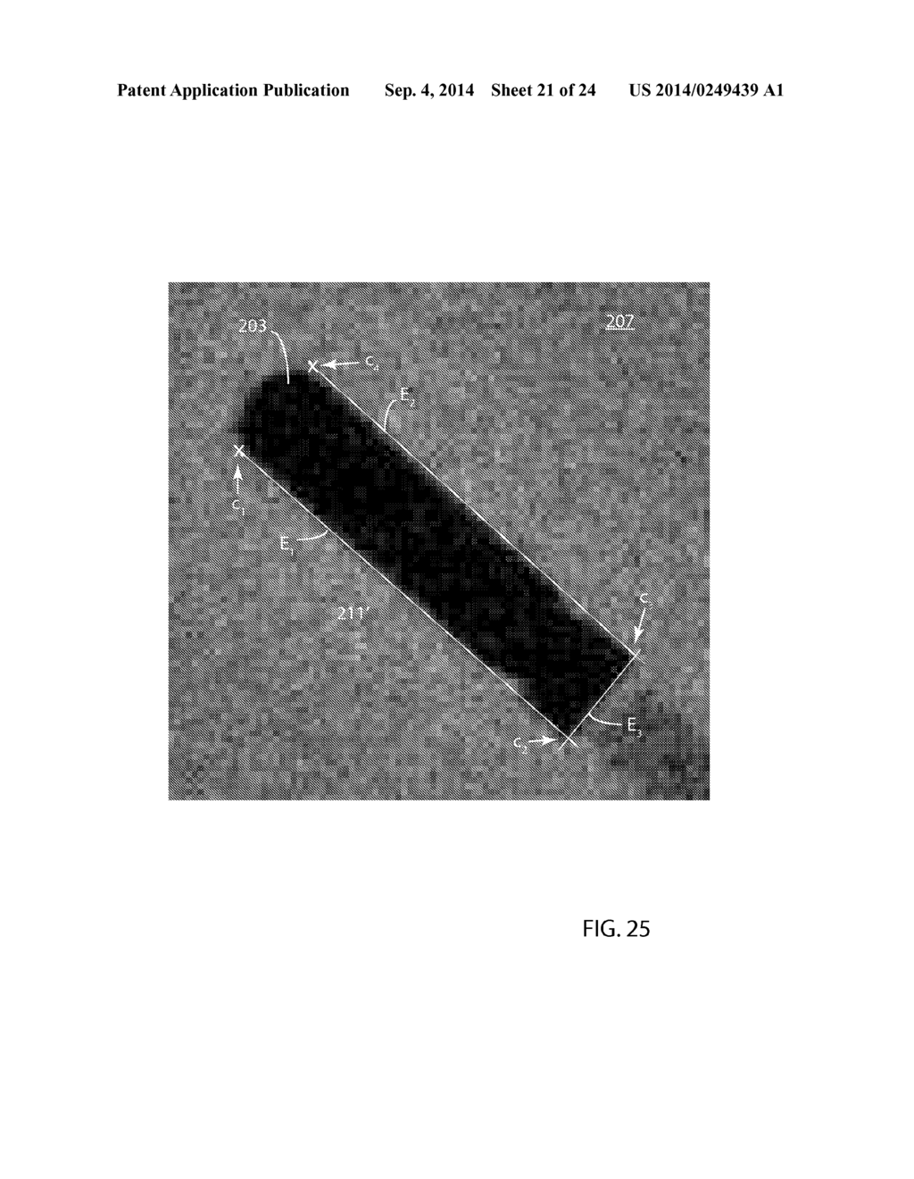 R-Wave Detection Method - diagram, schematic, and image 22