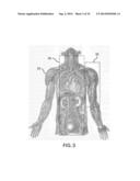 BODY-WORN SYSTEM FOR CONTINUOUS, NONINVASIVE MEASUREMENT OF CARDIAC     OUTPUT, STROKE VOLUME, CARDIAC POWER, AND BLOOD PRESSURE diagram and image