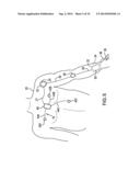 BODY-WORN SYSTEM FOR CONTINUOUS, NONINVASIVE MEASUREMENT OF CARDIAC     OUTPUT, STROKE VOLUME, CARDIAC POWER, AND BLOOD PRESSURE diagram and image