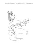 BODY-WORN SYSTEM FOR CONTINUOUS, NONINVASIVE MEASUREMENT OF CARDIAC     OUTPUT, STROKE VOLUME, CARDIAC POWER, AND BLOOD PRESSURE diagram and image