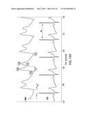 BODY-WORN SYSTEM FOR CONTINUOUS, NONINVASIVE MEASUREMENT OF CARDIAC     OUTPUT, STROKE VOLUME, CARDIAC POWER, AND BLOOD PRESSURE diagram and image