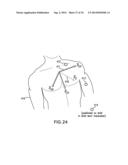 BODY-WORN SYSTEM FOR CONTINUOUS, NONINVASIVE MEASUREMENT OF CARDIAC     OUTPUT, STROKE VOLUME, CARDIAC POWER, AND BLOOD PRESSURE diagram and image