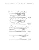 APPARATUS FOR TREATING VULNERABLE PLAQUE diagram and image