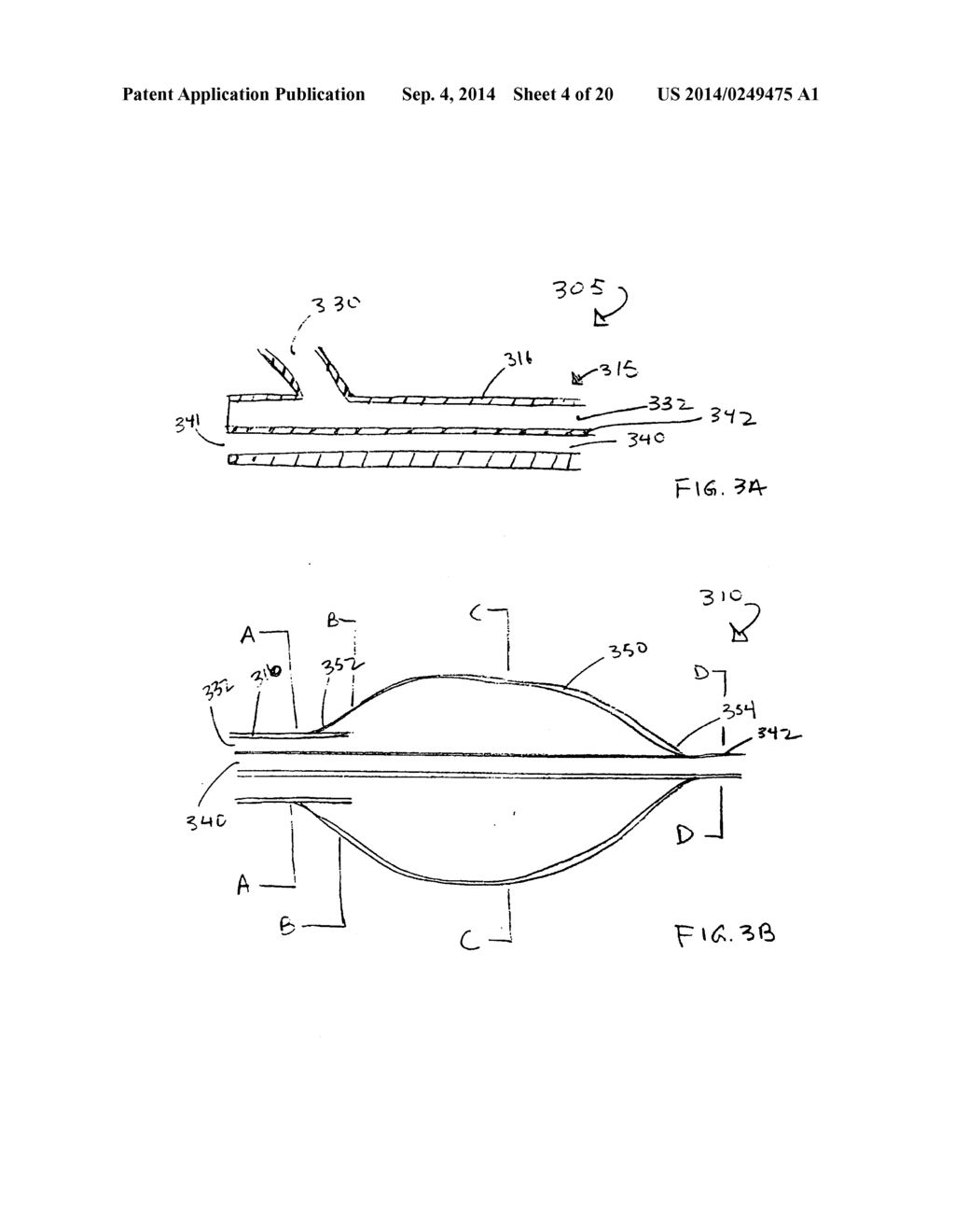 APPARATUS FOR TREATING VULNERABLE PLAQUE - diagram, schematic, and image 05