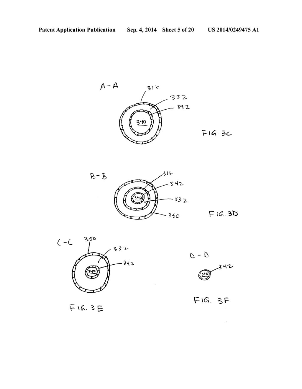 APPARATUS FOR TREATING VULNERABLE PLAQUE - diagram, schematic, and image 06