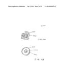 APPARATUS FOR TREATING VULNERABLE PLAQUE diagram and image