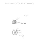 APPARATUS FOR TREATING VULNERABLE PLAQUE diagram and image