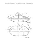 APPARATUS FOR TREATING VULNERABLE PLAQUE diagram and image