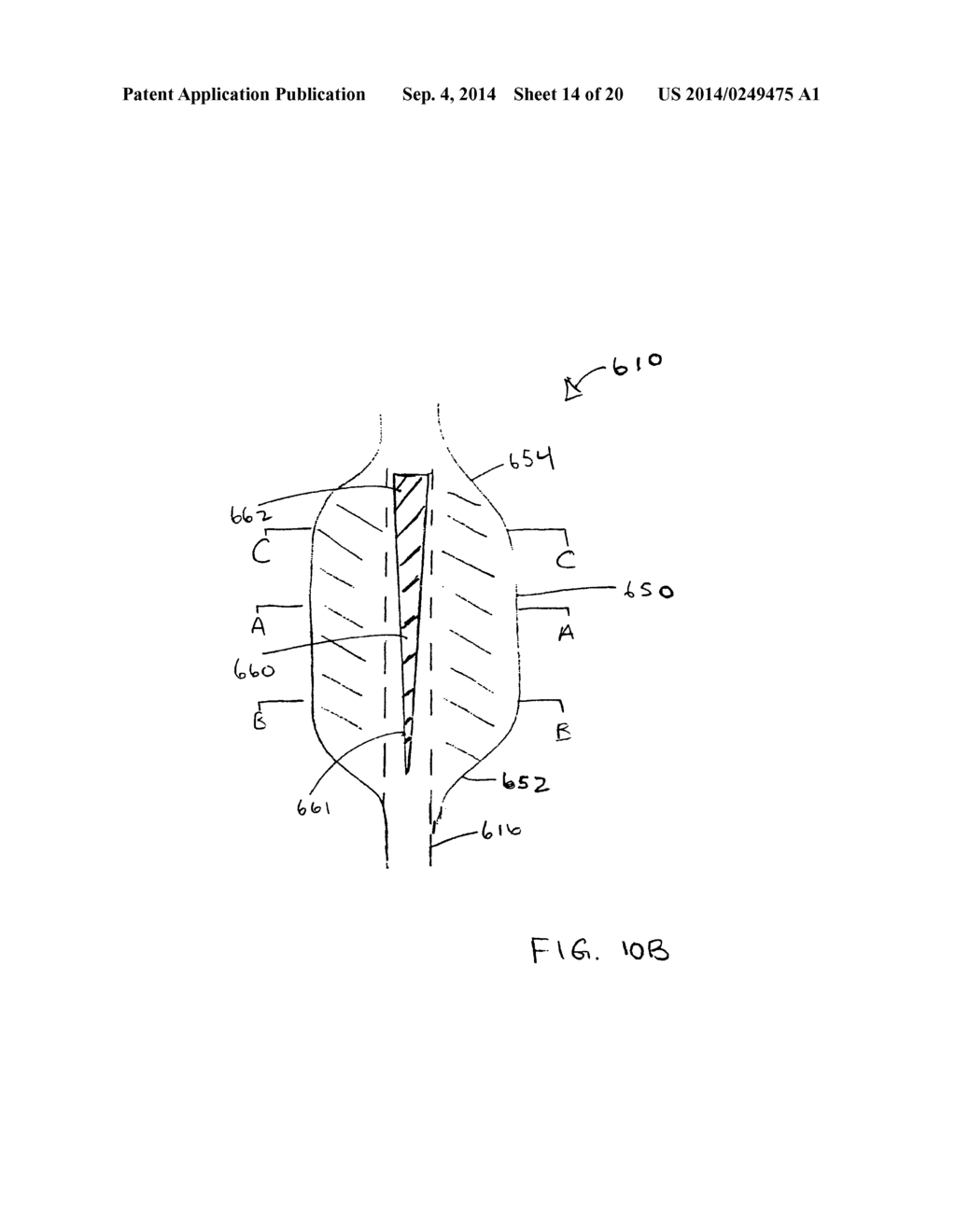 APPARATUS FOR TREATING VULNERABLE PLAQUE - diagram, schematic, and image 15