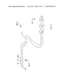 APPARATUS FOR TREATING VULNERABLE PLAQUE diagram and image