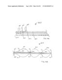 APPARATUS FOR TREATING VULNERABLE PLAQUE diagram and image