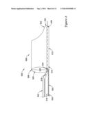 GUIDE EXTENSION CATHETER WITH A RETRACTABLE WIRE diagram and image