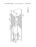 GUIDE EXTENSION CATHETER WITH A RETRACTABLE WIRE diagram and image