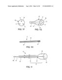 CATHETER APPARATUS AND METHODS FOR TREATING VASCULATURES diagram and image