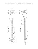 CATHETER APPARATUS AND METHODS FOR TREATING VASCULATURES diagram and image