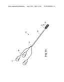 CATHETER APPARATUS AND METHODS FOR TREATING VASCULATURES diagram and image