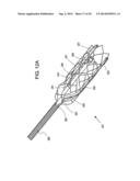 CATHETER APPARATUS AND METHODS FOR TREATING VASCULATURES diagram and image