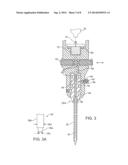 PAIN MANAGEMENT USING CRYOGENIC REMODELING diagram and image