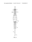 PAIN MANAGEMENT USING CRYOGENIC REMODELING diagram and image