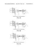 PAIN MANAGEMENT USING CRYOGENIC REMODELING diagram and image